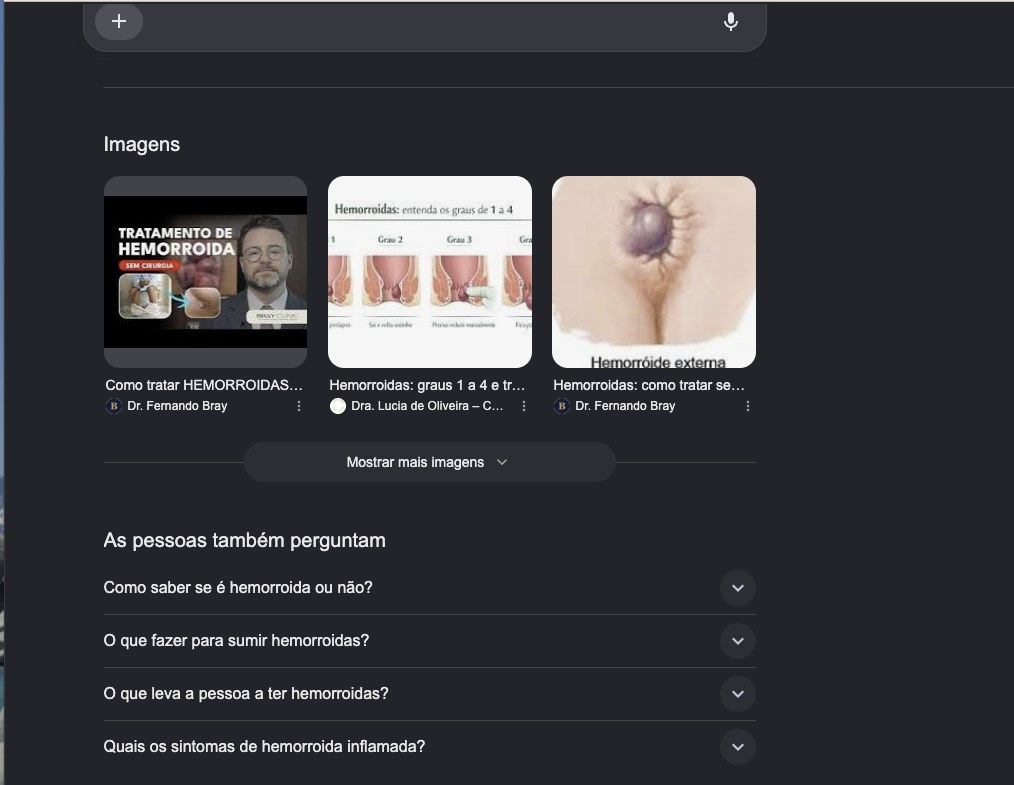 Bloco de imagens do Google para hemorroida com duas das três primeiras imagens do Dr. Fernando Bray